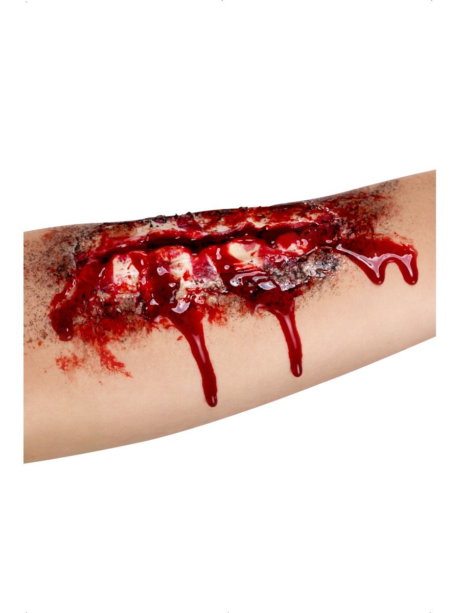Open Wound Latex Scar